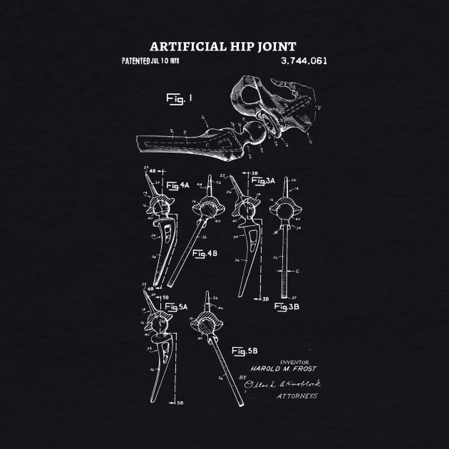 Artificial Hip 1973 Patent , Prosthetic hip Patent Artificial hip, Prosthetics Office Wall Art Print, Doctors Patent Illustration by Anodyle